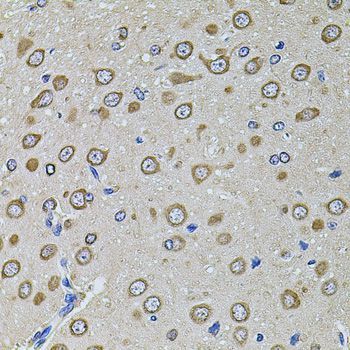 Immunohistochemistry - EIF4A2 Polyclonal Antibody (144-03849)