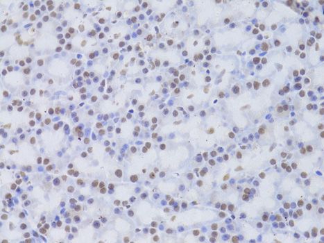 Immunohistochemistry - [KO Validated] CSNK1E Polyclonal Antibody (144-01796)