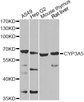 Western blot - CYP3A5 Antibody (144-07663)