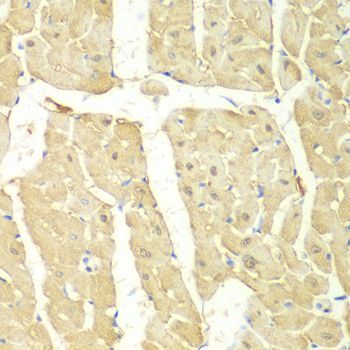 Western blot - PSMC2 Polyclonal Antibody (144-01985)