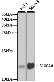 Western blot - [KO Validated] S100A4 Polyclonal Antibody (144-01631)