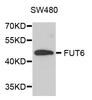 Western blot - FUT6 antibody (144-03868)