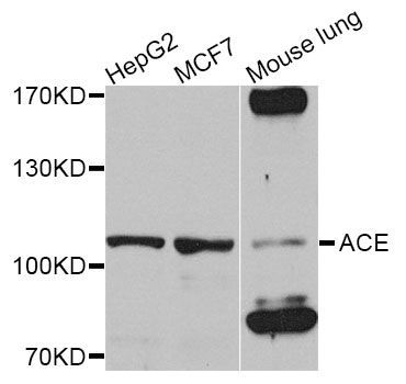 Western blot - ACE antibody (144-02805)