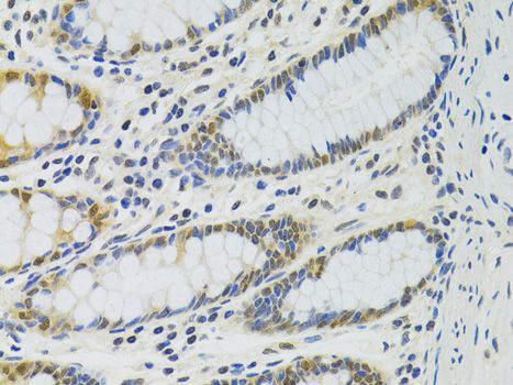 Immunohistochemistry - PPP4C Polyclonal Antibody (144-02109)
