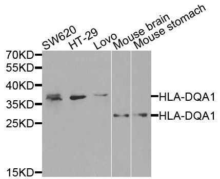 Western blot - HLA-DQA1 antibody (144-02168)