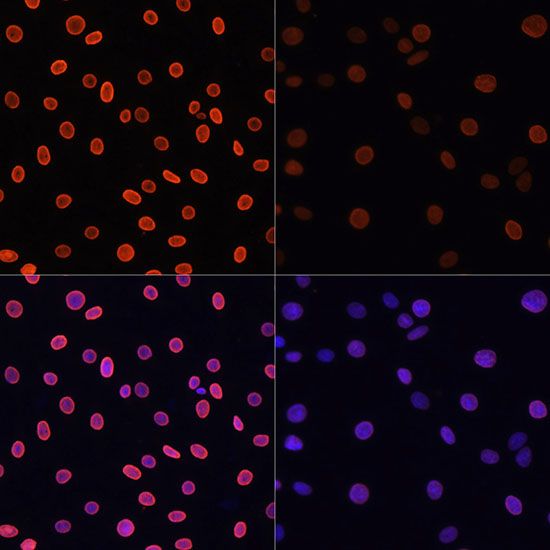 Western blot