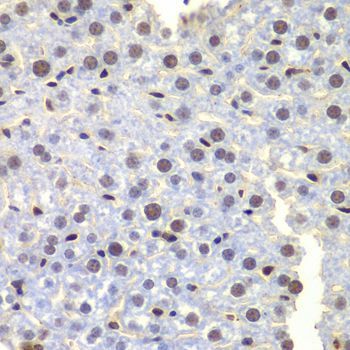 Immunohistochemistry - LHX4 antibody (144-08072)