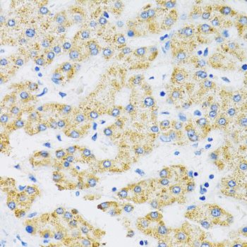 Immunohistochemistry - SLC16A4 Polyclonal Antibody (144-60809)