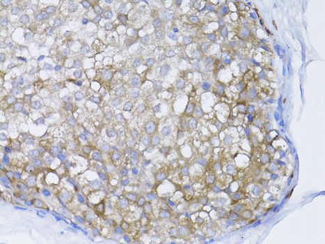 Immunohistochemistry - BRCA1 Polyclonal Antibody (144-00212)
