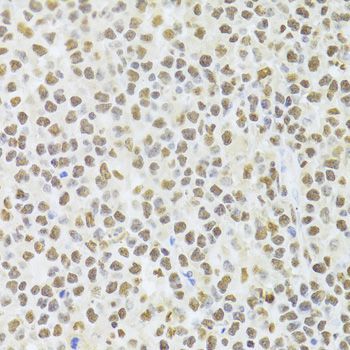 Immunohistochemistry - ANP32A Antibody (144-05768)