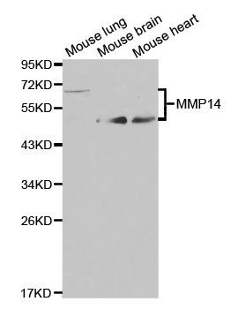 Western blot - MMP14 antibody (144-02549)