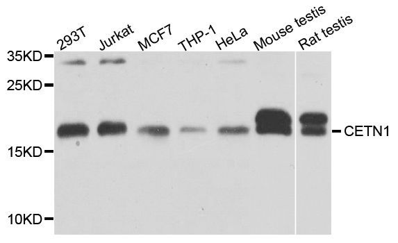 Western blot - CETN1 antibody (144-03784)