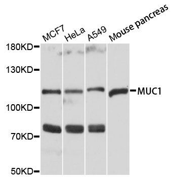 Western blot - MUC1 Polyclonal Antibody (144-00333)