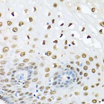 Immunohistochemistry - UBC antibody (144-03207)