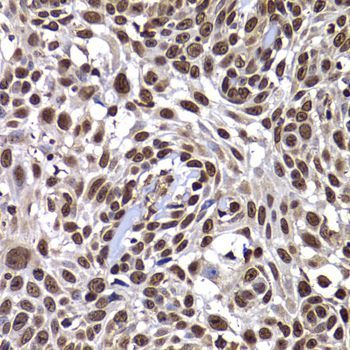 Immunohistochemistry - DNAJB6 Polyclonal Antibody (144-07052)
