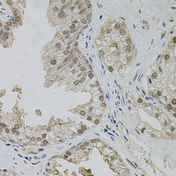 Immunohistochemistry - MAPK1 Polyclonal Antibody (144-011186)