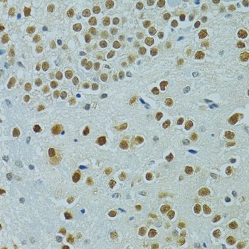 Immunohistochemistry - MUS81 antibody (144-06818)