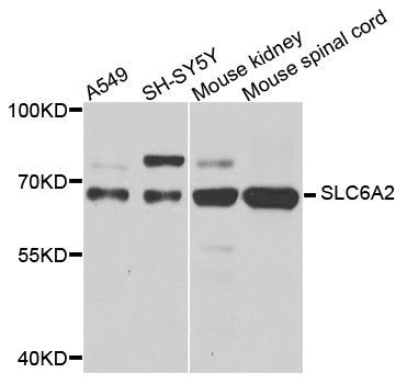 Western blot - SLC6A2 antibody (144-01421)