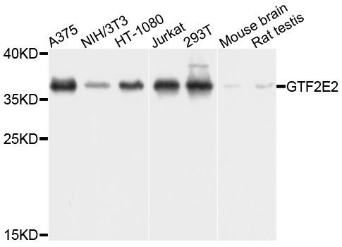 Western blot - GTF2E2 Polyclonal Antibody (144-08732)