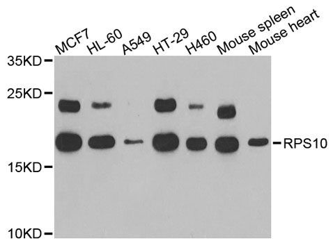 Western blot - RPS10 antibody (144-06056)