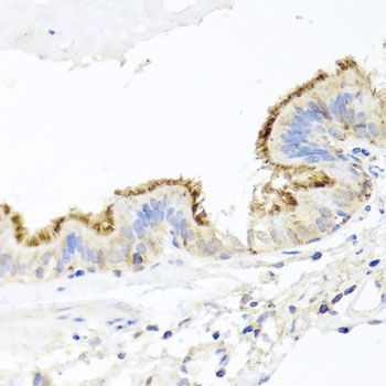 Immunohistochemistry - CD44 Polyclonal Antibody (144-00340)