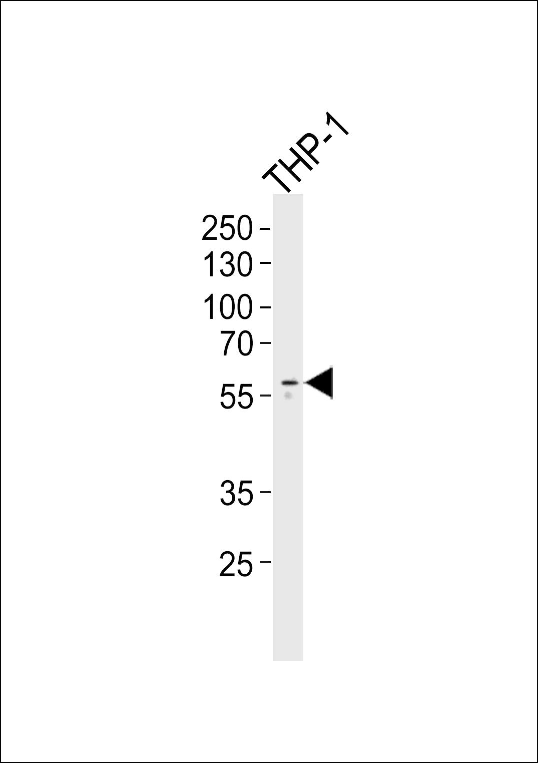 WB