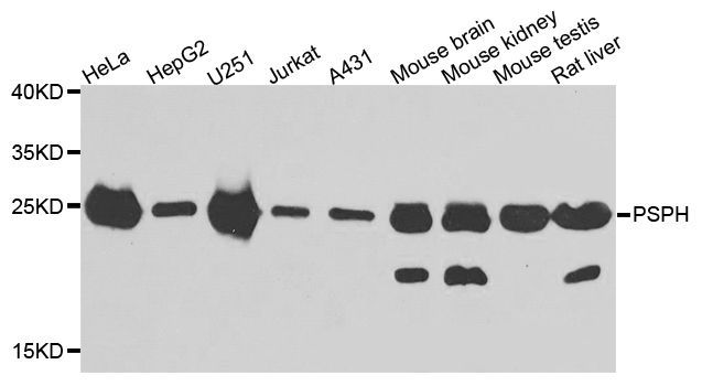 Western blot - PSPH antibody (144-07924)