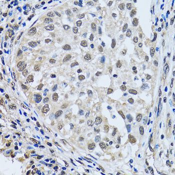 Immunohistochemistry - LSM4 Polyclonal Antibody (144-05891)