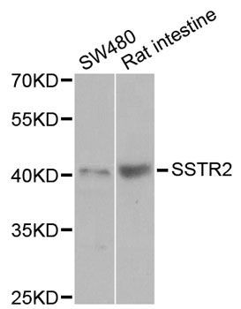 Western blot - SSTR2 antibody (144-03135)