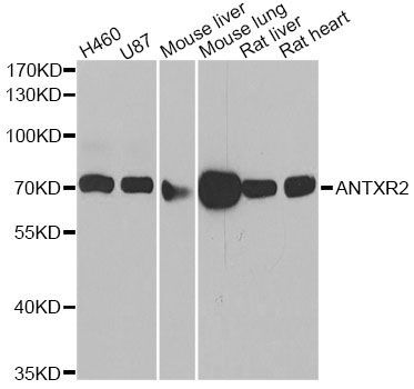 Western blot - ANTXR2 antibody (144-06526)