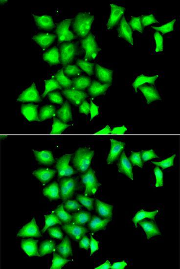 Immunofluorescence - MSRB1 antibody (144-06737)