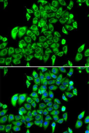 Immunohistochemistry - RPL13 Polyclonal Antibody (144-06723)