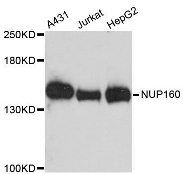Western blot - NUP160 antibody (144-60177)