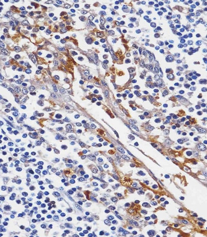 IHC-P