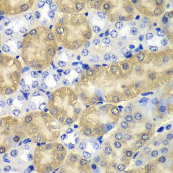 Immunohistochemistry - AMY1A antibody (144-60260)
