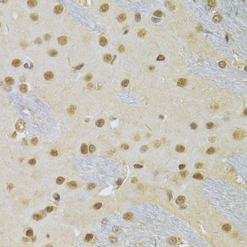 Immunohistochemistry - RUNX1 Antibody (144-02055)