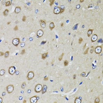 Western blot - RPS10 Polyclonal Antibody (144-05880)
