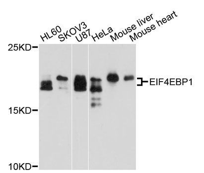 Western blot - [KO Validated] EIF4EBP1 Polyclonal Antibody (144-01248)