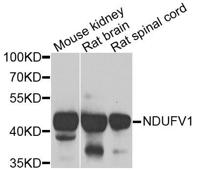 Western blot - NDUFV1 antibody (144-60287)