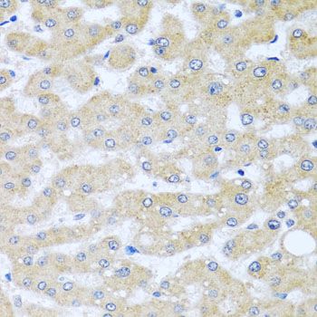 Immunohistochemistry - BCKDK antibody (144-08184)