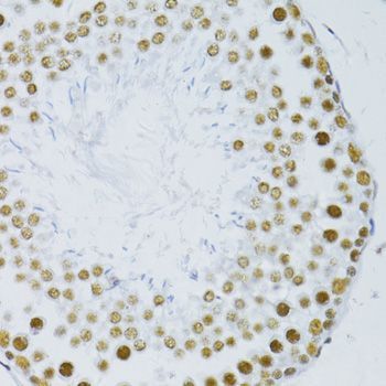 Immunohistochemistry - SNRNP70 antibody (144-06065)