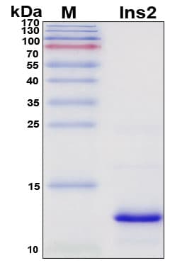 SDS-PAGE Image
