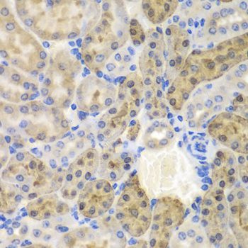 Immunohistochemistry - AKR1A1 antibody (144-60399)