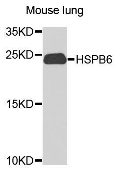 Western blot - HSPB6 Polyclonal Antibody (144-09887)