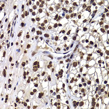Immunohistochemistry - DNAJB6 Polyclonal Antibody (144-07052)