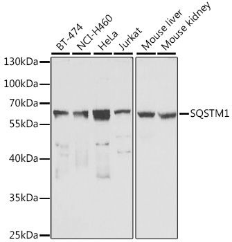 Western blot - SQSTM1 Polyclonal Antibody (144-07758)