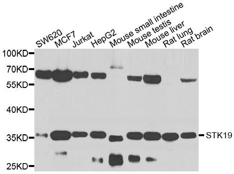 Western blot - STK19 antibody (144-07574)