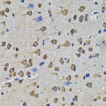 Immunohistochemistry - N6AMT1 Antibody (144-07201)