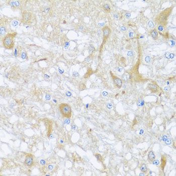 Immunohistochemistry - SULT1A1 antibody (144-01599)