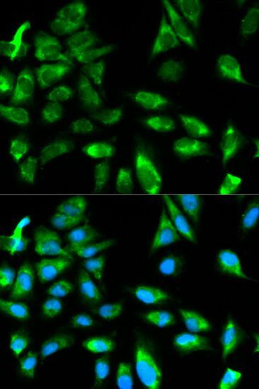 Immunofluorescence - TRAF6 Polyclonal Antibody (144-00973)